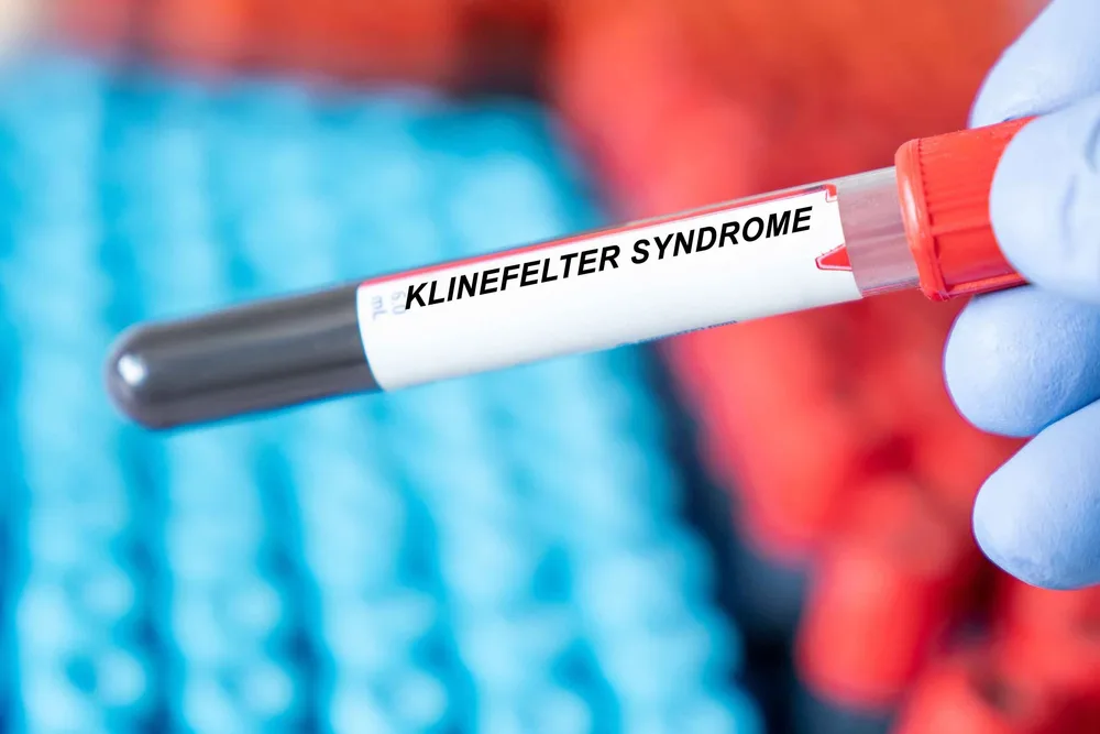 Klinefelter Sendromu Nedir?