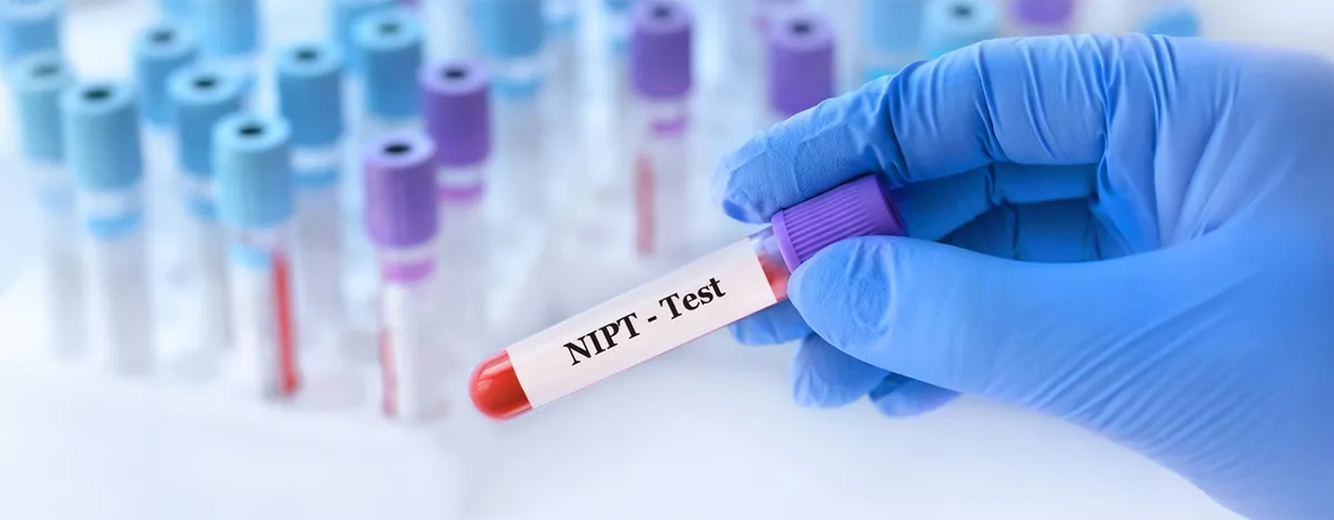Non-İnvaziv Prenatal Test (NIPT)