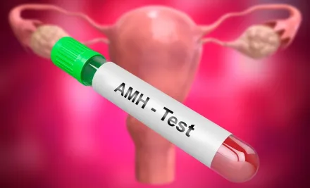 AMH Testi Nedir? Yumurtalık Rezervi, OHSS Riski ve Tüp Bebek Tedavisine Etkisi